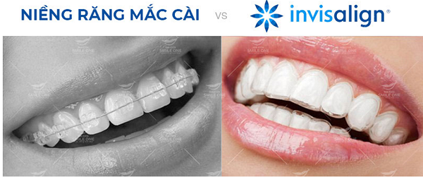 Ths.Bs Nguyễn Tuấn Dương - người tạo nên cơn sốt chỉnh nha Invisalign tại Việt Nam