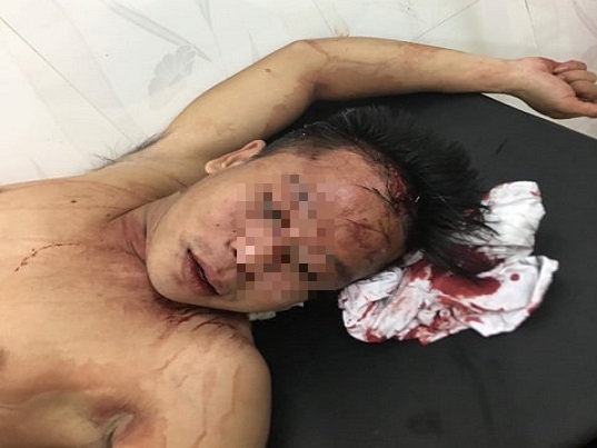 Thanh Hoá: VKSND huyện Hậu Lộc có bỏ lọt tội phạm?