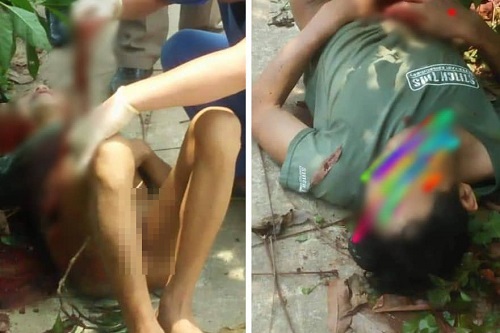 Nghi do uống rượu say, người đàn ông tự cầm dao mổ bụng mình