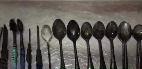 Kỳ lạ người đàn ông nghiện ăn thìa, nĩa, dao và bàn chải