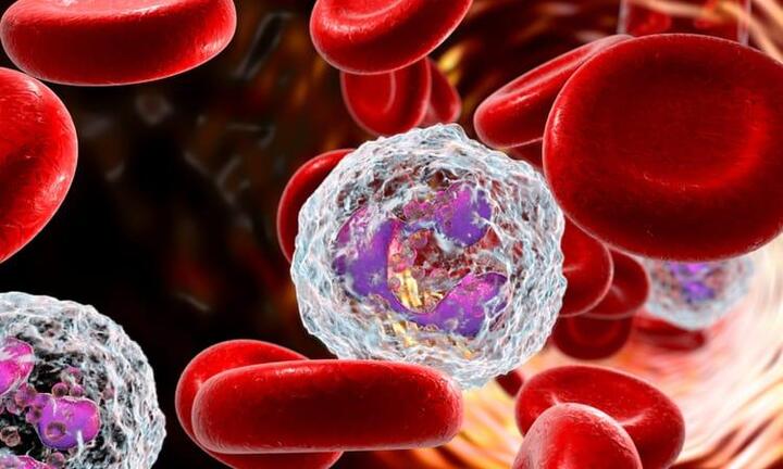 Hệ lụy của việc suy giảm bạch cầu ở bệnh nhân ung thư hóa xạ trị? Giải pháp cho bệnh nhân?