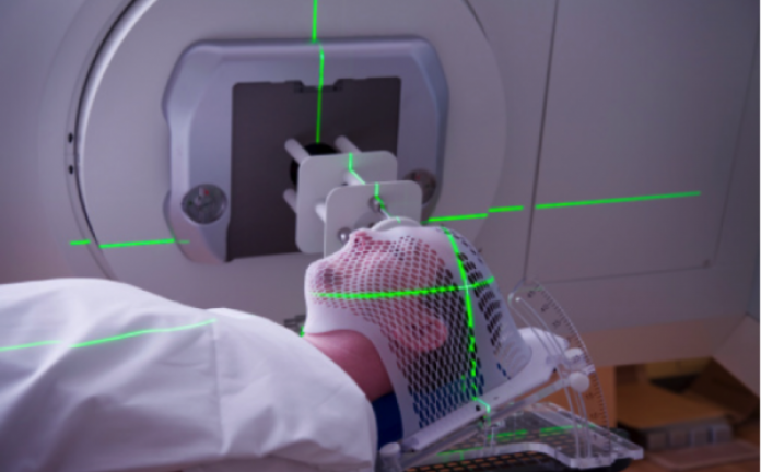 Xạ trị là gì? Bệnh nhân có nên sử dụng phương pháp này không?