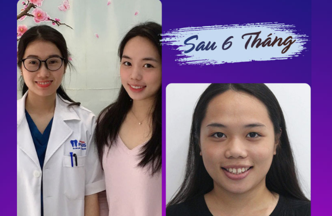 Trải nghiệm dịch vụ nha khoa theo tiêu chuẩn Pháp ngay tại Việt Nam