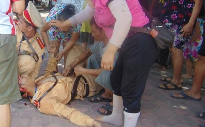 Bình Dương: Nhắc nhở không được quay clip, thiếu úy công an bị  chém trọng thương