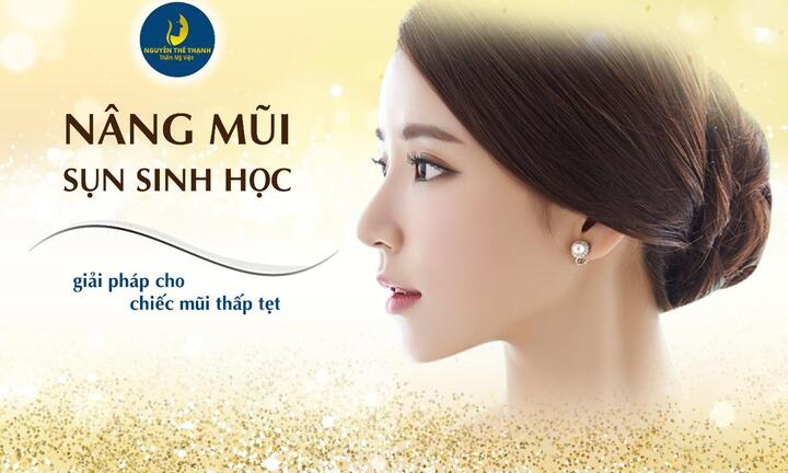Nâng mũi sụn sinh học: Giải pháp cho chiếc mũi thấp tẹt