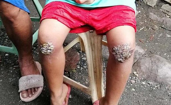 Xót xa bé gái 8 tuổi quên mang cặp sách về, bị mẹ phạt quỳ trên than hồng