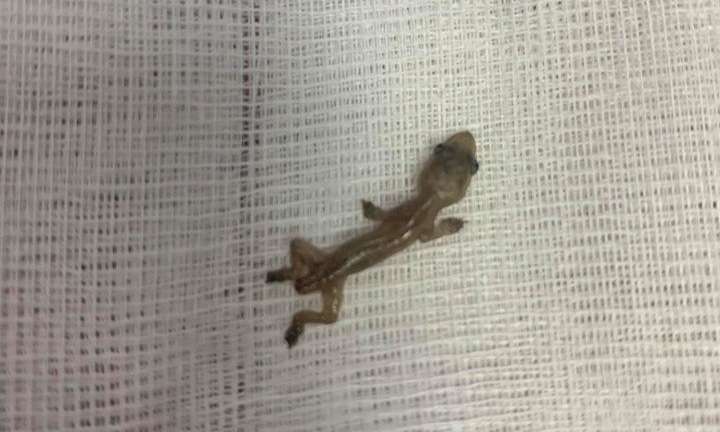 Bác sĩ hoảng hốt phát hiện loài bò sát sống trong tai bệnh nhân