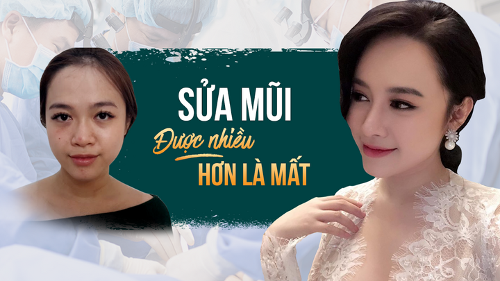 Lựa chọn sửa mũi - Được nhiều hơn là mất