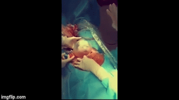 Video: Khoảnh khắc kì diệu em bé chào đời còn nguyên trong bọc ối, chớp mắt mỉm cười với bác sĩ