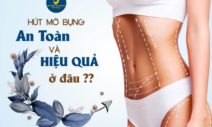 Địa chỉ hút mỡ bụng hiệu quả và an toàn?