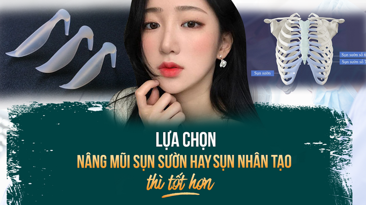 Nâng mũi sụn sườn & nâng mũi sụn nhân tạo: Kẻ 8 lạng người nửa cân