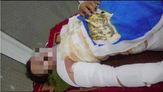 Cãi vã trong khi say xỉn, gã chồng 'hờ' tưới xăng thiêu sống vợ