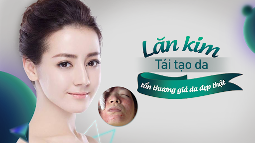 Lăn kim tái tạo da - Tạo tổn thương giả giúp da đẹp hoàn hảo