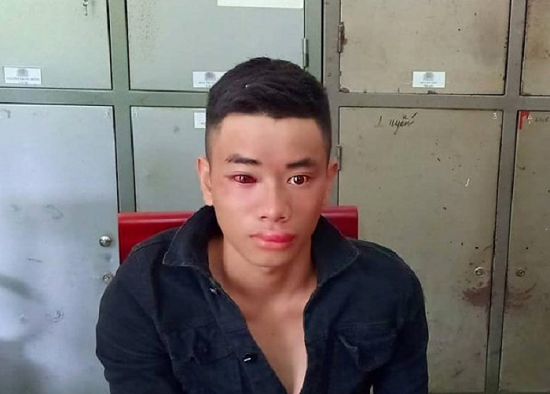 Tạm giữ con nghiện dùng kim tiêm vừa sử dụng đâm thiếu úy công an