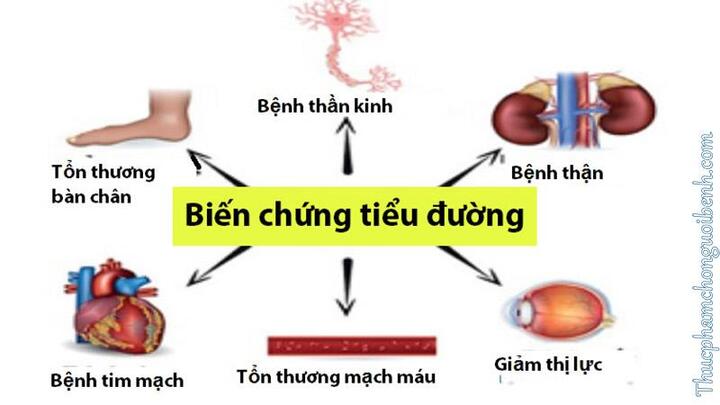 Bệnh lý tiểu đường và biến chứng của bệnh