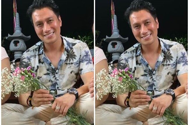 Việt Anh bị chê kém sắc, mặt cứng đơ sau gần 2 tháng phẫu thuật thẩm mỹ