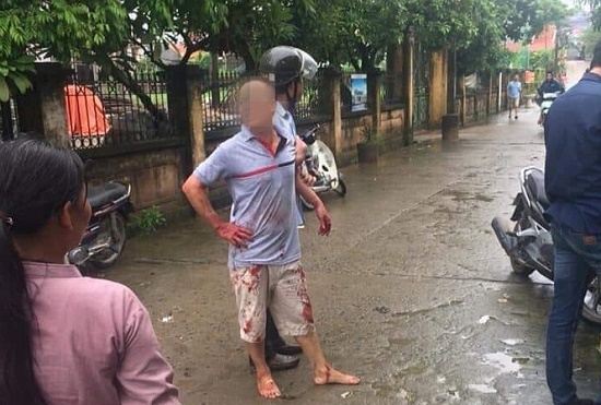 Vụ anh chém 5 người gia đình em ruột thương vong ở Hà Nội: Nghi can có thể đối diện mức án tử hình