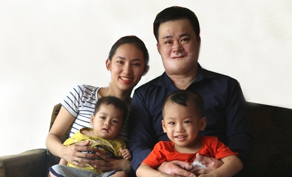 Tình yêu chân thành thắp lên hy vọng cho chàng trai bất hạnh