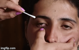 Cô gái Armenia đau đớn vì khóc ra 50 dị vật như thủy tinh mỗi ngày