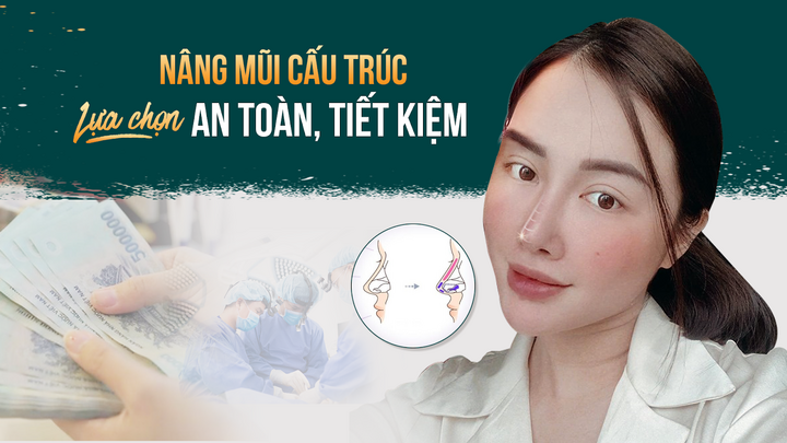 Nâng mũi cấu trúc - Lựa chọn 