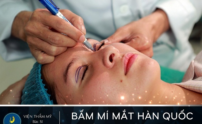 Bấm mí mắt Hàn Quốc – Mắt long lanh hút ánh nhìn