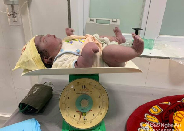 Khâm phục bà mẹ sinh thường bé gái nặng 5,5 kg ở Nghệ An