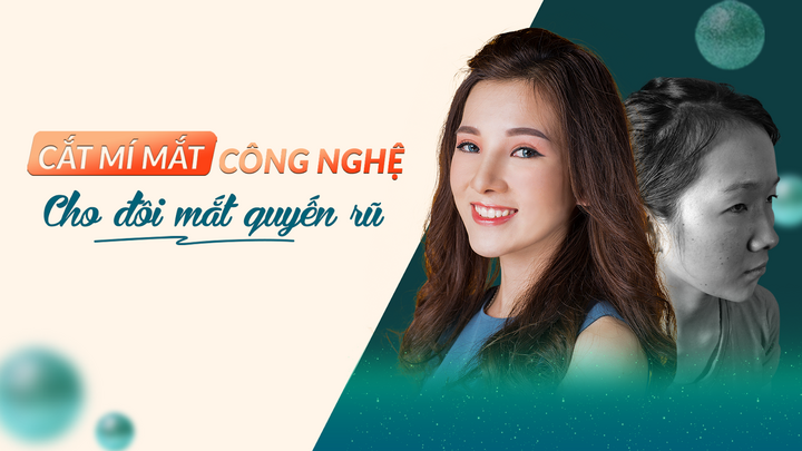 Cắt mí mắt - Công nghệ hiện đại cho đôi mắt quyến rũ chuẩn Hàn