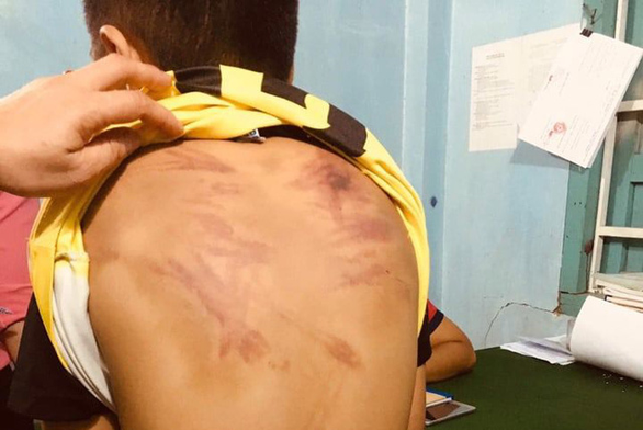 Đề nghị truy tố 