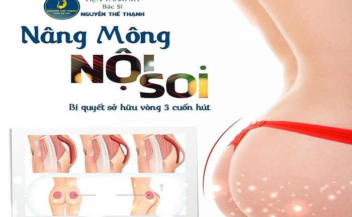 Nâng mông nội soi – Bí quyết sở hữu vòng 3 cuốn hút