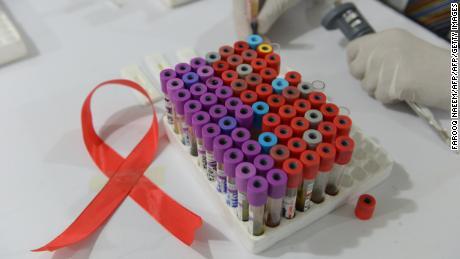 Chủng mới đầu tiên của HIV lần đầu được phát hiện sau gần 20 năm