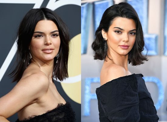 Bí quyết quét sạch mụn của siêu mẫu thế giới Kendall Jenner