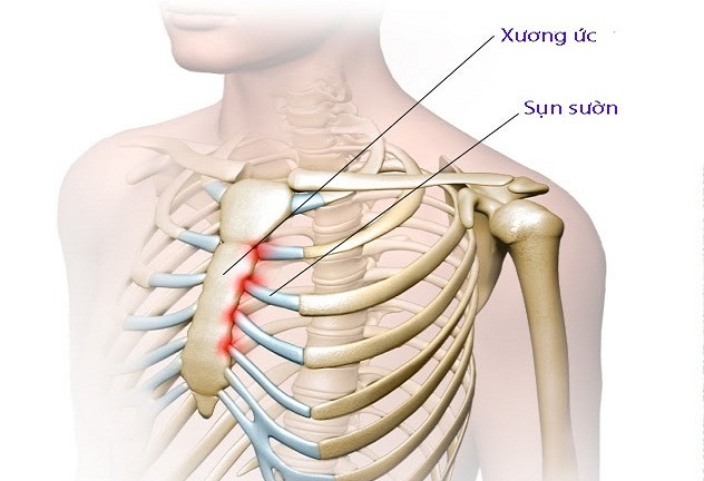 Nâng mũi bằng sụn sườn, liệu đã là phương pháp chỉnh sửa tốt nhất?
