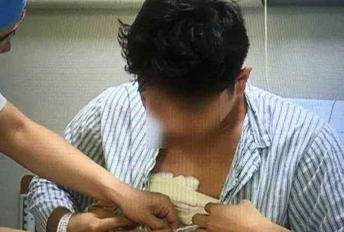 Kỳ lạ thanh niên sau khi đi làm một năm tăng hơn 25kg, ngực tiết ra dịch sữa