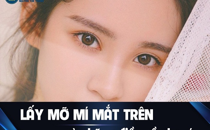 Lấy mỡ mí mắt trên và những điều cần lưu ý