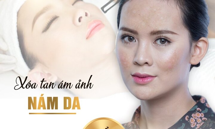 Thẩm mỹ viện quốc tế Bắc Mỹ trị nám uy tín tại Thanh Hóa
