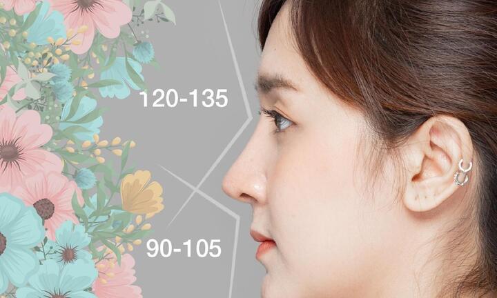 Nâng mũi S-line bán cấu trúc - Mũi đẹp thanh tao