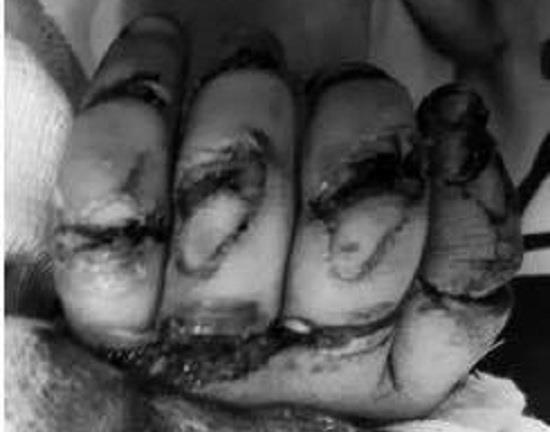 Bé 2 tuổi dập nát tay vì máy rửa xe, bài học đắt giá cho bố mẹ khi để con chơi một mình