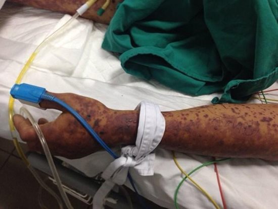 Hàng ngàn người Việt chết mỗi năm vì món ăn