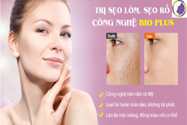 Thẩm mỹ viện quốc tế Bắc Âu điều trị sẹo 1 lần duy nhất
