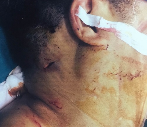 Vụ cố ý gây thương tích tại quận Hà Đông, TP Hà Nội: Đủ yếu tố cấu thành tội phạm, vì sao vẫn chưa khởi tố? 