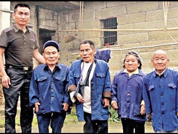 Vì sao có nhiều người bị lùn hơn rất nhiều so với người khác?