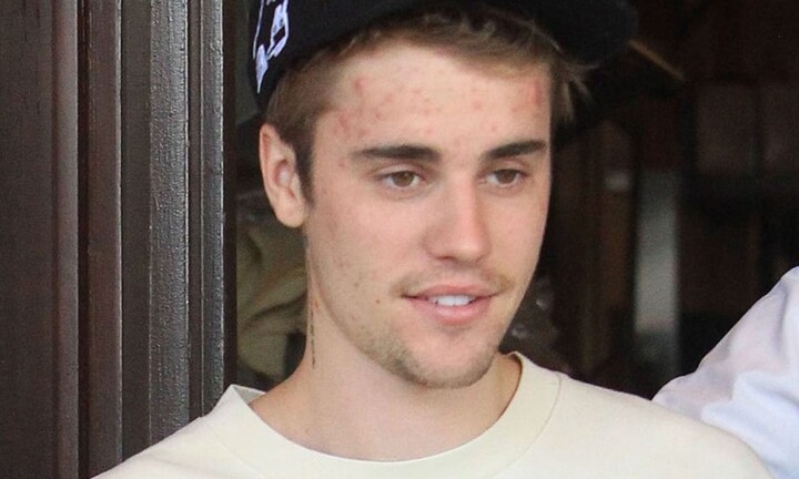 Căn bệnh mà hoàng tử nhạc pop Justin Bieber mắc phải nguy hiểm cỡ nào?