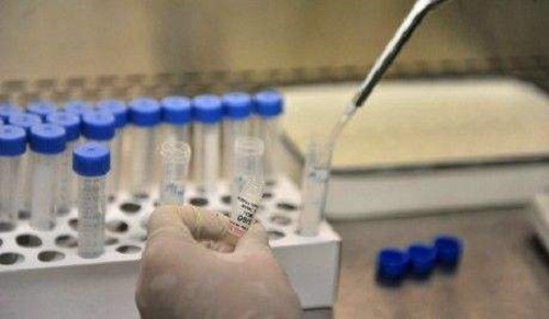 Tình hình dịch virus corona ngày 1/2: 9.952 ca nhiễm bệnh, Nga khuyến nghị 3 loại thuốc điều trị 2019-nCov