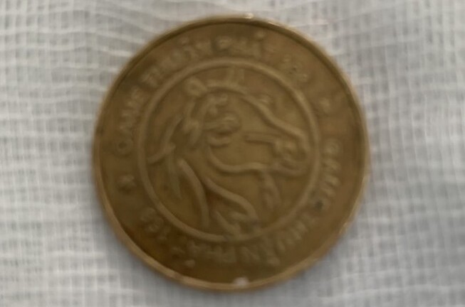 Tin tức đời sống mới nhất ngày 9/2/2020: Chơi game, bé trai nuốt đồng xu vào thực quản