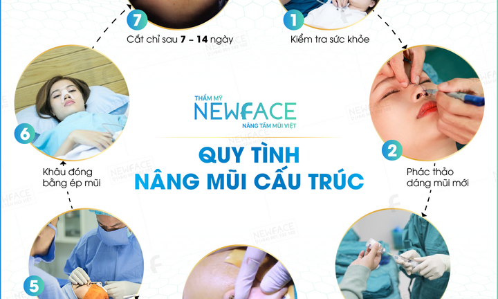 Sự thật đằng sau việc thẩm mỹ viện Newface bị tố làm hỏng mũi