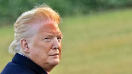 Tổng thống Trump bức xúc vì bức ảnh làn da bị “cháy nắng” giả