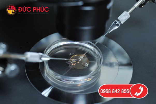 ICSI là gì - tìm hiểu về kỹ thuật bơm tinh trùng vào bào tương trứng