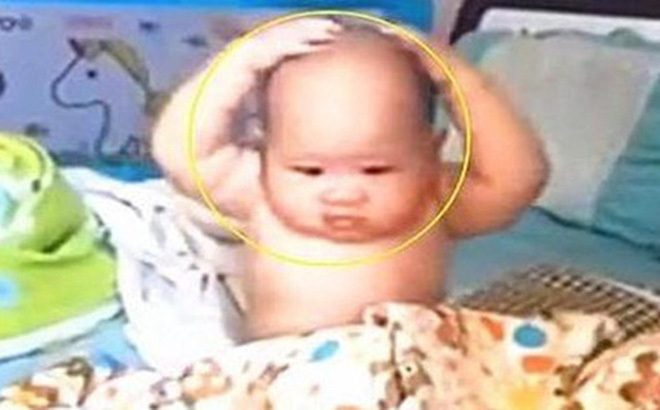 Ngủ dậy phát hiện tóc trên đầu đã bay sạch, phản ứng của cậu bé mới là điều gây