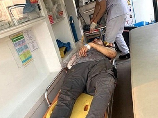 Tin tai nạn giao thông mới nhất ngày 31/3/2020: Người đàn ông bị tàu hỏa cán lìa tay