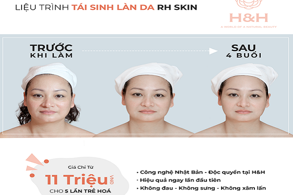 RH - Skin - Thành tựu siêu tái sinh trẻ hoá làn da của Nhật Bản - Lần đầu có mặt tại Việt Nam
